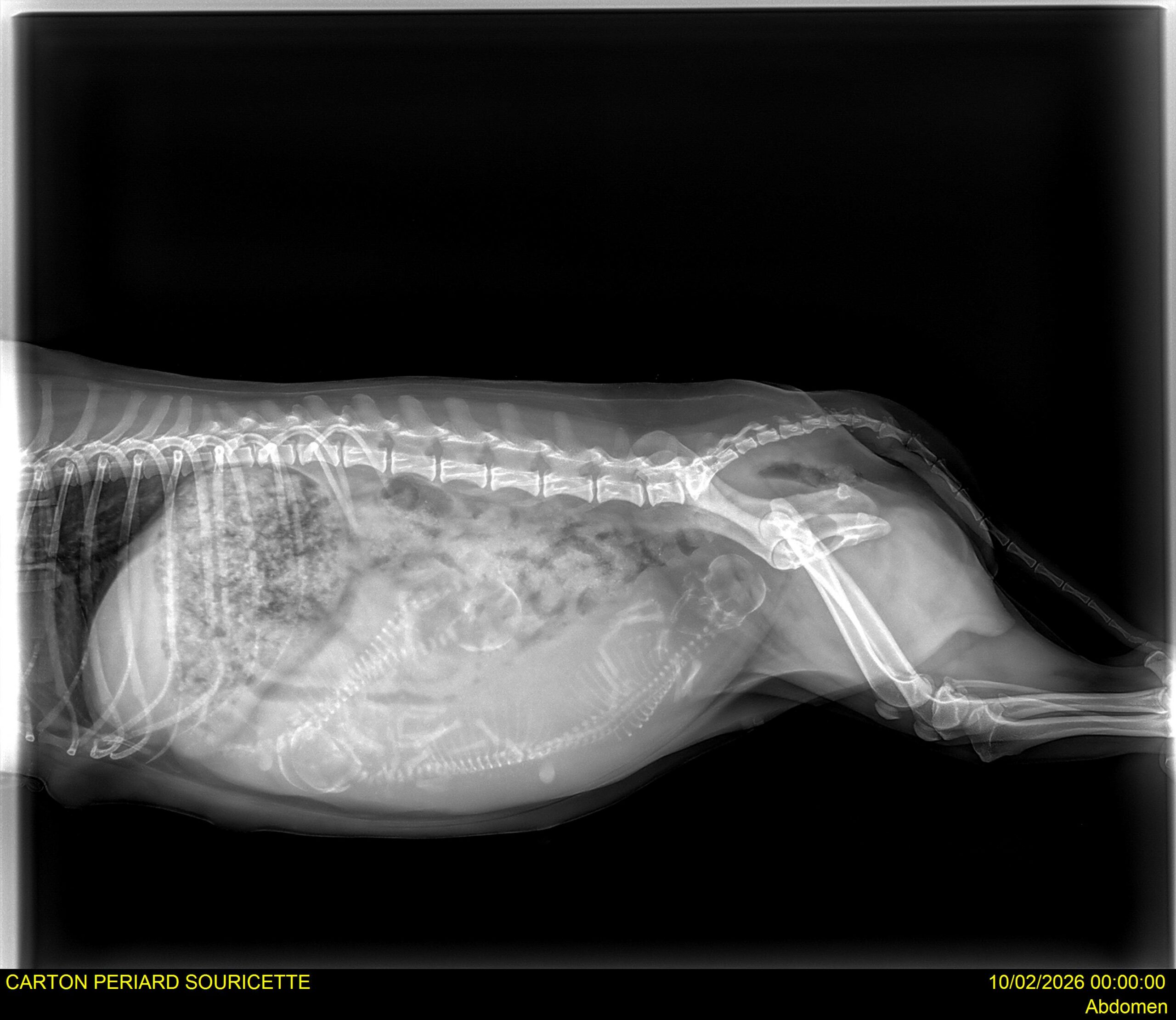 Abdomen - 0003 - 20260210